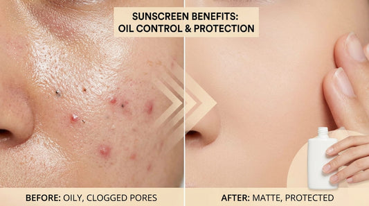 Sunscreen for Oily Skin: How to Avoid Clogged Pores and Breakouts